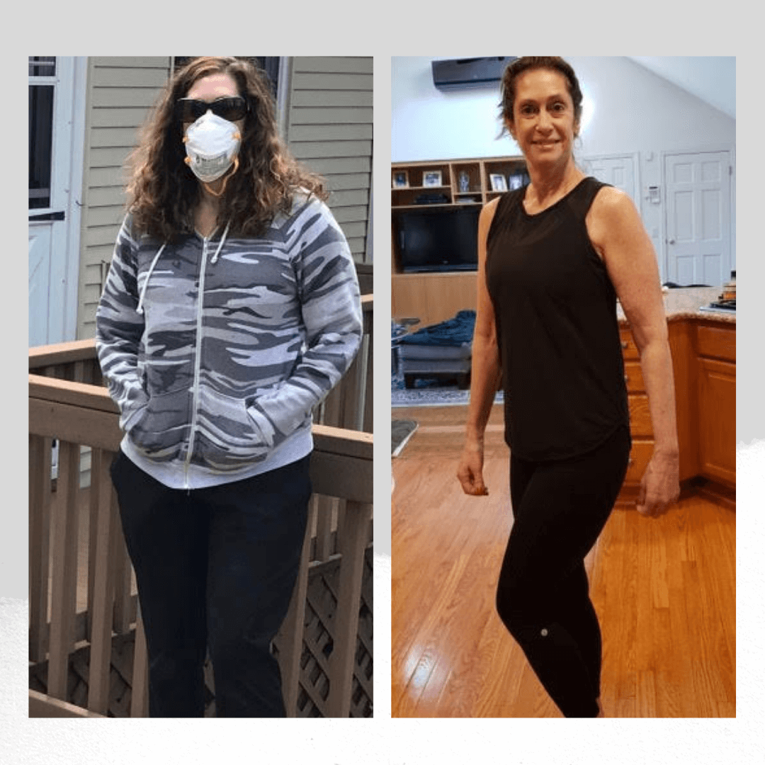 Zo Program Before-After photo 10