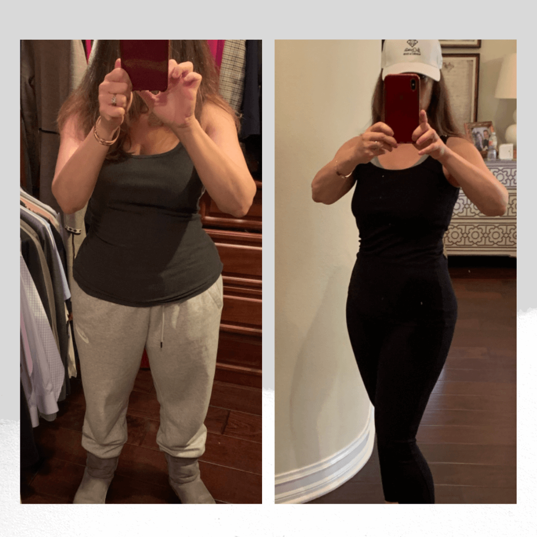 Zo Program Before-After photo 9